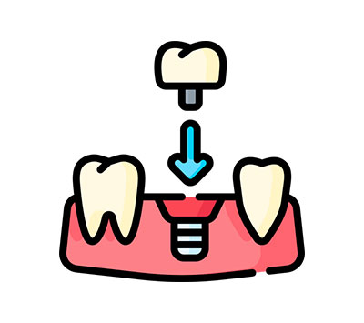 Implant Dentistry