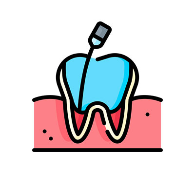 Hypnotherapy for Dental Anxiety